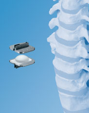 artificial disc spine surgery