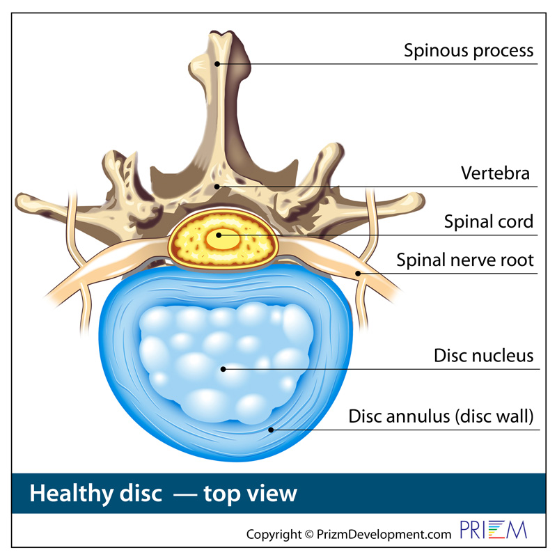 healthy disc